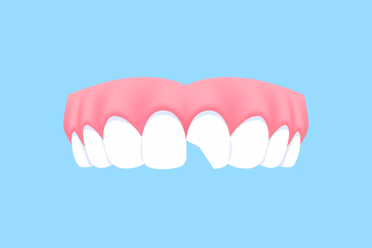 Do cracked teeth heal on their own what nj patients need to know blog