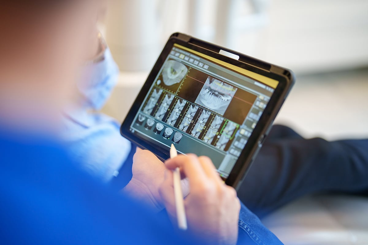 Root canal recovery time whats normal and whats not blog